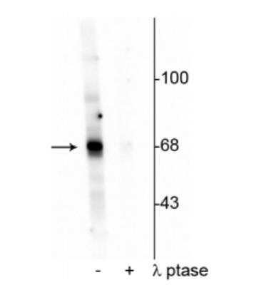 Western Blot: AKT [p Thr342] Antibody [NBP2-60772]